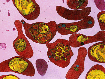 Imagen: Micrografía electrónica de transmisión, a color, de un corte a través de eritrocitos infectados con el parásito de la malaria (Foto cortesía del Dr. Gopal Murti / SPL).